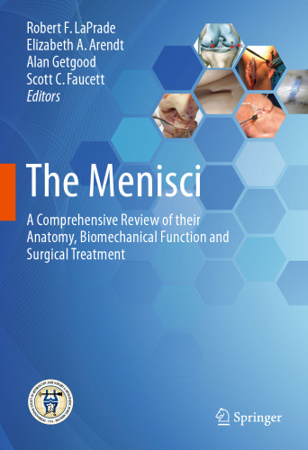 The Menisci: A Comprehensive Review of their Anatomy, Biomechanical Function and Surgical Treatment