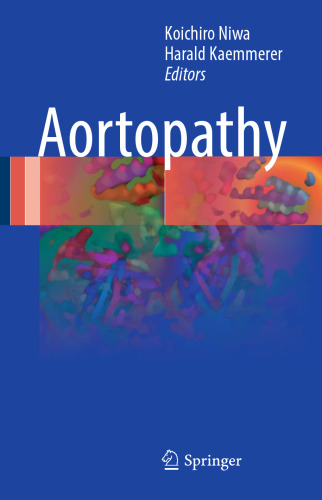 Aortopathy