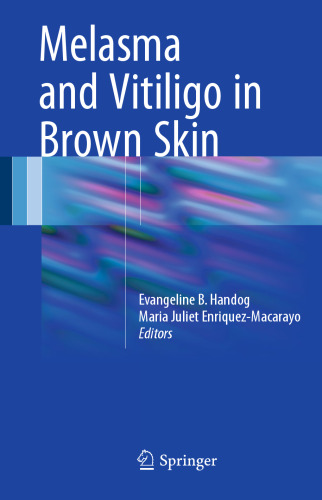 Melasma and Vitiligo in Brown Skin