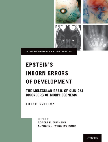 Epstein's inborn errors of development : the molecular basis of clinical disorders of morphogenesis