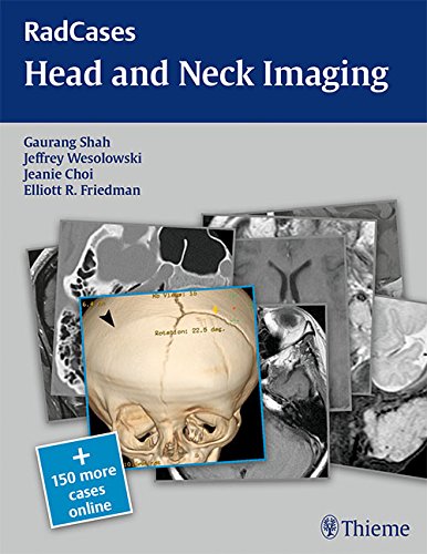 head and neck imaging