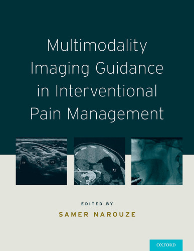 Multimodality imaging guidance in interventional pain management