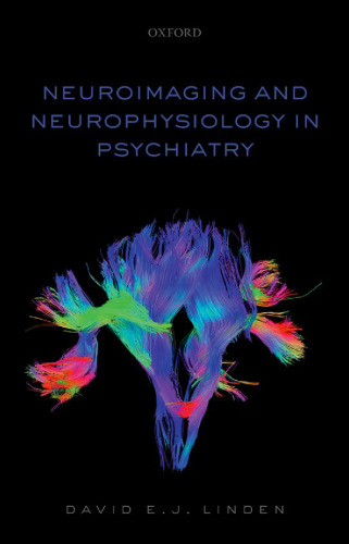Neuroimaging and neurophysiology in psychiatry