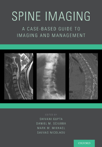 Spine imaging : a case-based guide to imaging and management