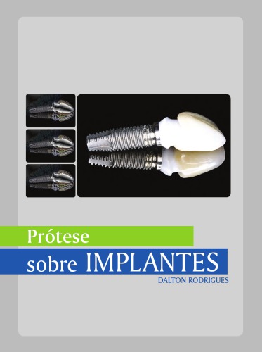 Manual de protese sobre implantes - Passos Clinicos e Laboratoriais