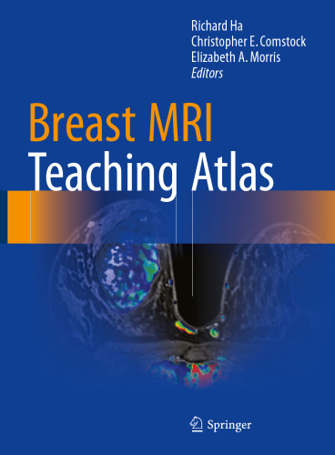 Breast MRI Teaching Atlas