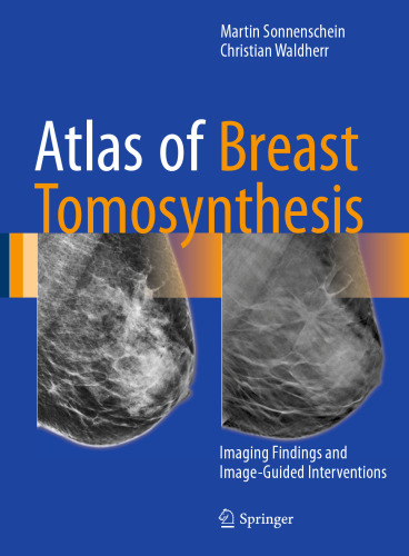 Atlas of Breast Tomosynthesis: Imaging Findings and Image-Guided Interventions