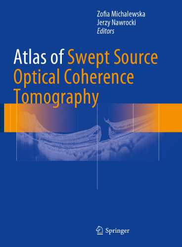 Atlas of Swept Source Optical Coherence Tomography 