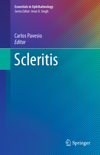 Scleritis
