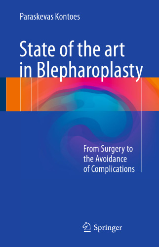 State of the art in Blepharoplasty: From Surgery to the Avoidance of Complications