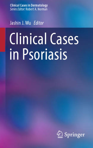 Clinical Cases in Psoriasis