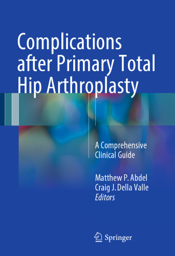Complications after Primary Total Hip Arthroplasty: A Comprehensive Clinical Guide