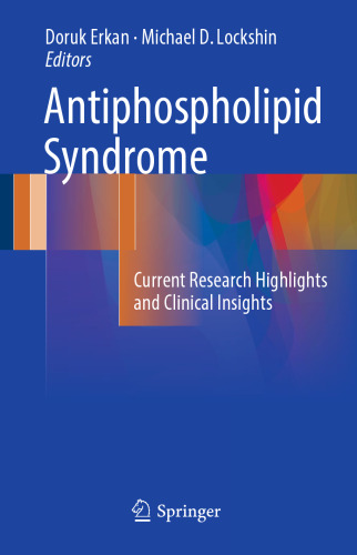 Antiphospholipid Syndrome: Current Research Highlights and Clinical Insights