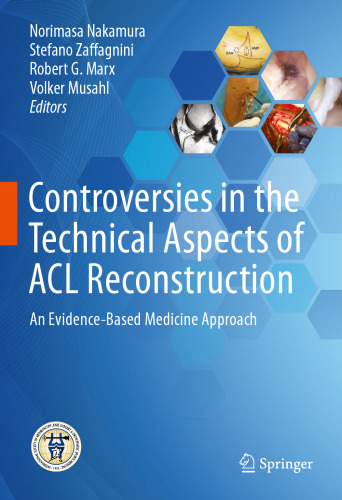 Controversies in the Technical Aspects of ACL Reconstruction: An Evidence-Based Medicine Approach