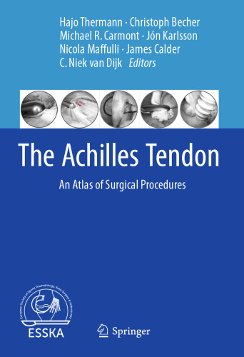 The Achilles Tendon: An Atlas of Surgical Procedures