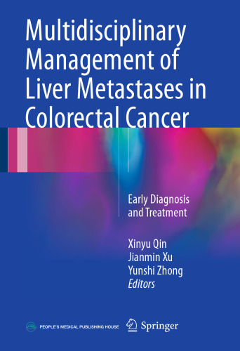 Multidisciplinary Management of Liver Metastases in Colorectal Cancer: Early Diagnosis and Treatment