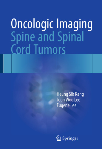 Oncologic Imaging: Spine and Spinal Cord Tumors