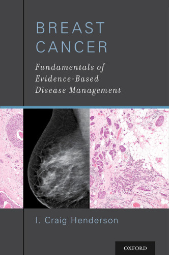 Breast Cancer Fundamentals of Evidence-Based Disease Management