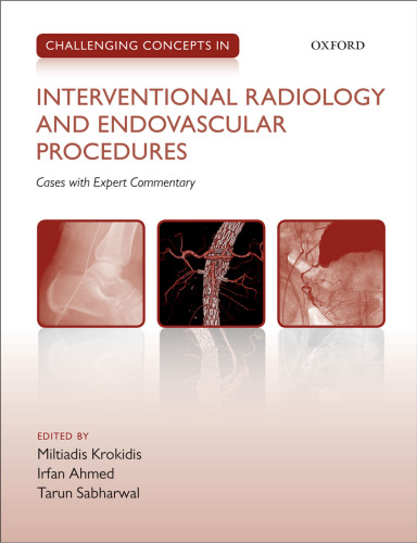 Challenging concepts in interventional radiology and endovascular procedures : cases with expert commentary