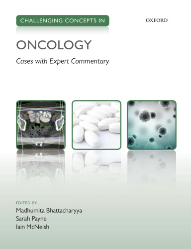 Challenging concepts in oncology : cases with expert commentary