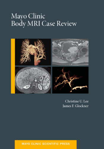 Mayo Clinic body MRI case review