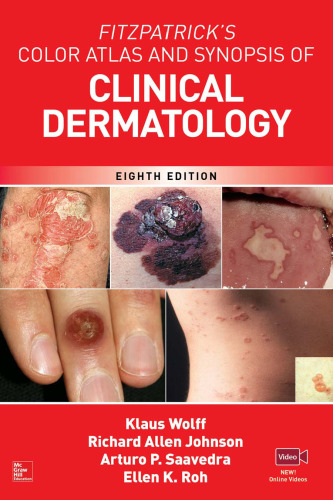 Fitzpatrick’s Color Atlas and Synopsis of Clinical Dermatology