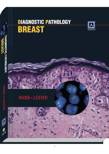 Breast