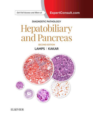 Hepatobiliary and Pancreas