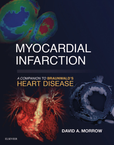 Myocardial infarction : a companion to Braunwald’s heart disease