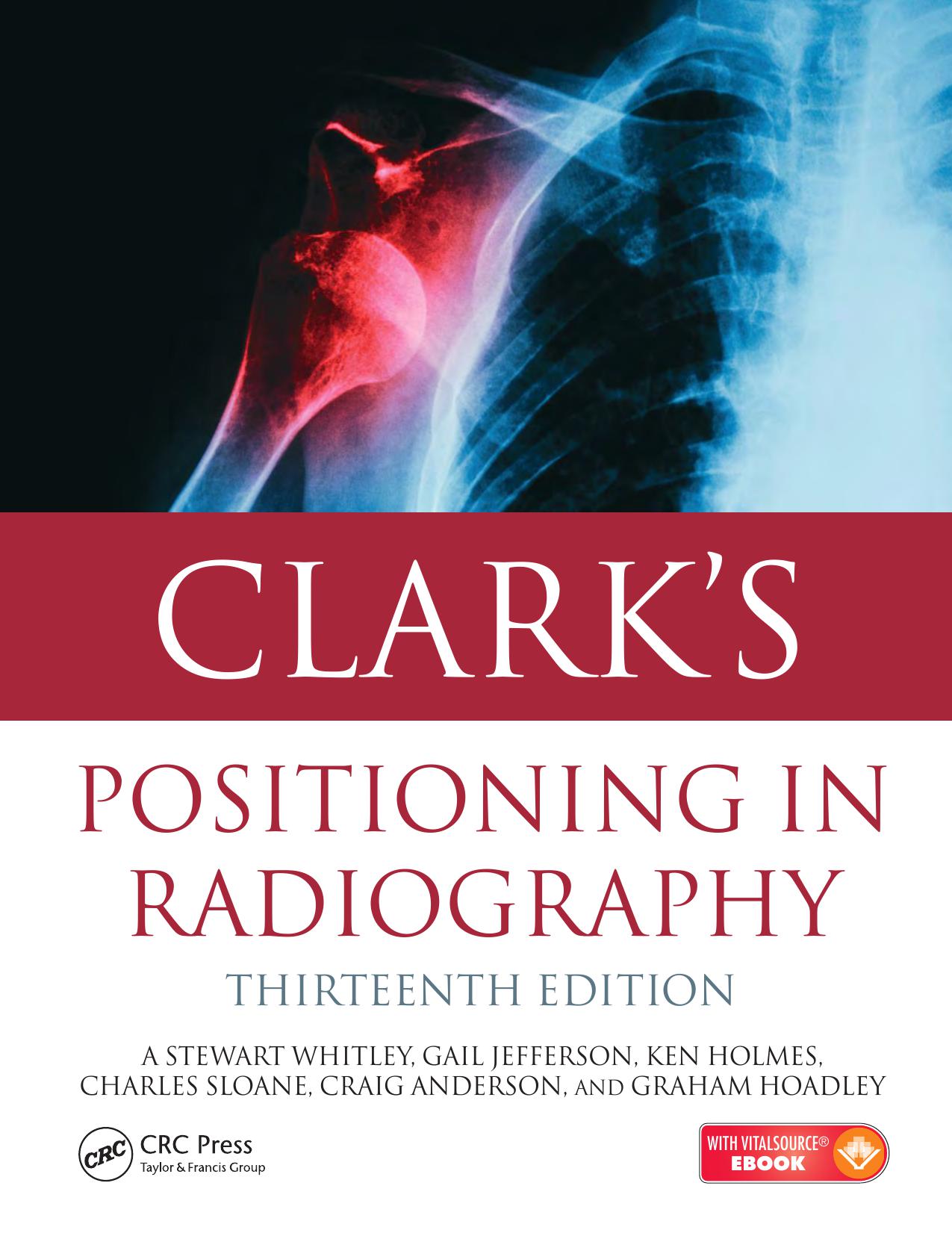 Clark’s positioning in radiography
