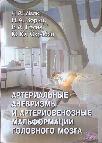 Артериальные аневризмы и артериовенозные мальформации головного мозга