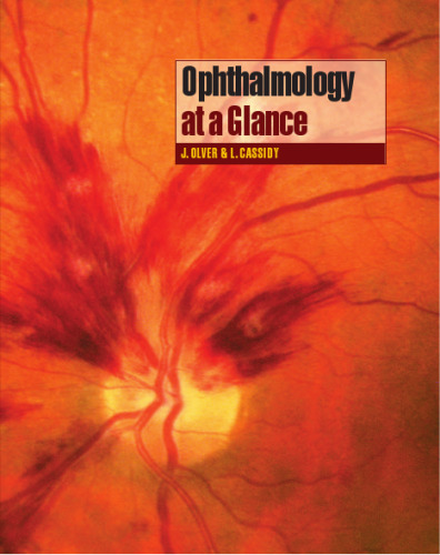 Ophthalmology At a Glance
