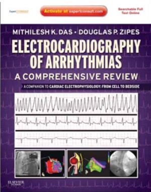 Electrocardiography of Arrhythmias: A Comprehensive Review