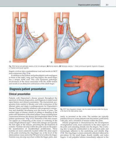 Plastic Surgery. Volume 6. Hand. Part 2
