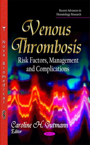 Venous Thrombosis. Risk Factors, Management and Complications