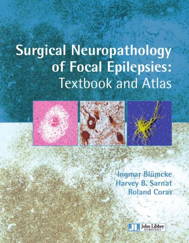 Surgical Neuropathology of Focal Epilepsies