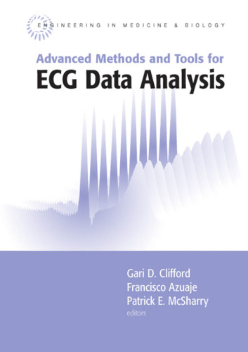 Advanced Methods And Tools for ECG Data Analysis