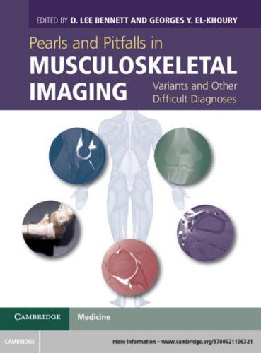 Pearls and Pitfalls in Musculoskeletal Imaging: Variants and Other Difficult Diagnoses
