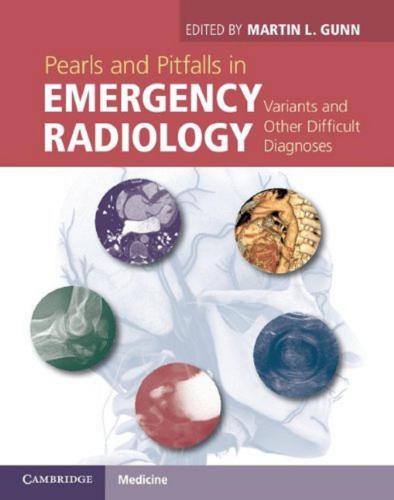 Pearls and Pitfalls in Emergency Radiology