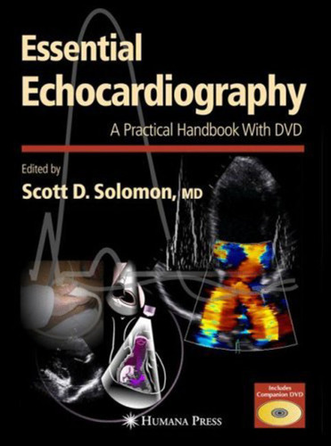Essential Echocardiography: A Practical Handbook with DVD