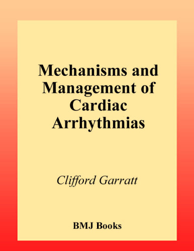 Mechanisms and Management of Cardiac Arrhythmias