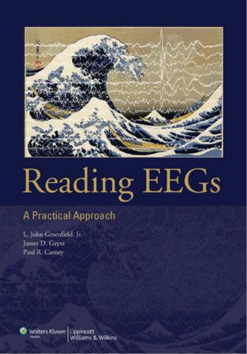 Reading EEGs: A Practical Approach
