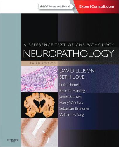 Neuropathology A reference text of CNS pathology Part 3