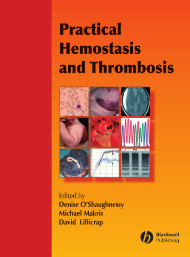 Practical Hemostasis and Thrombosis