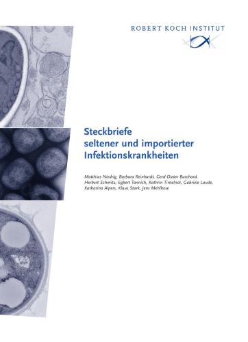 Steckbriefe seltener und importierter Infektionskrankheiten