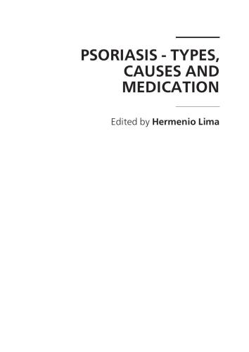 Psoriasis: Types, Causes and Medication