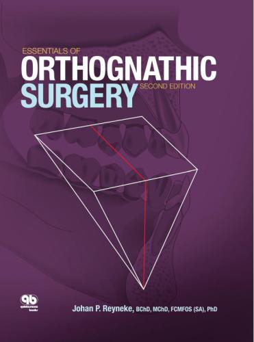 Essentials of Orthognathic Surgery