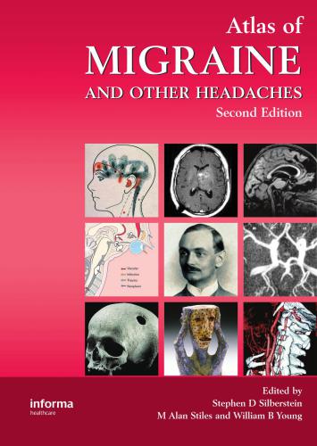 Atlas of Migraine and Other Headaches