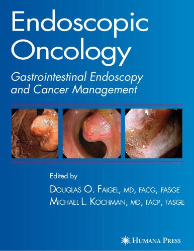 Endoscopic Oncology. Gastrointestinal Endoscopy and Cancer Management