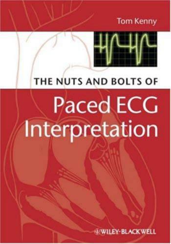 The Nuts and bolts of Paced ECG Interpretation/ЭКГ при кардиостимуляции